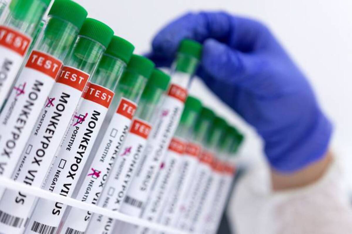 The World Health Organization said the virus isn't likely to evolve into a pandemic. (Dado Ruvic/Reuters)