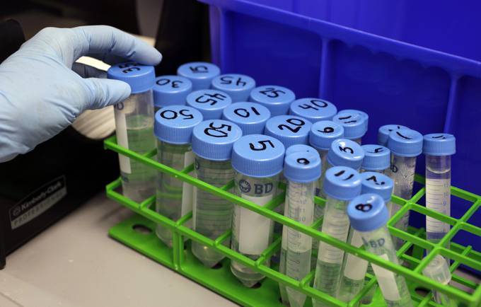 A researcher works in a stem cell lab. (Paul Sakuma/AP)